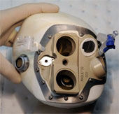 The first patient in the world to install an artificial heart died
