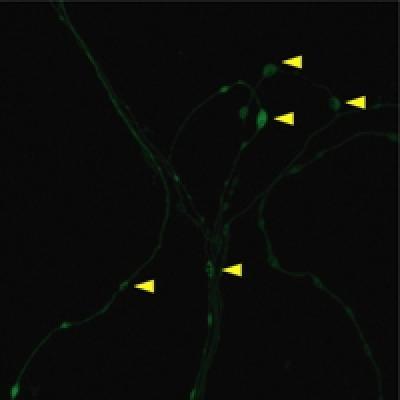 The first sketch image of the mechanism of memory formation