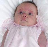 The first step of a little girl with