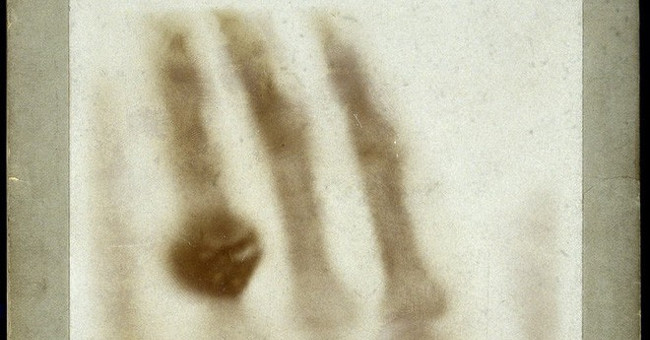 The first X-ray image made his wife invent it to be startled