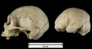 The fossil Hobbit is not of a new breed of Homonid family.