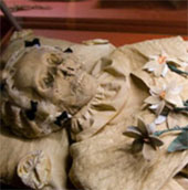 The germ of TB germs in a 200-year mummy