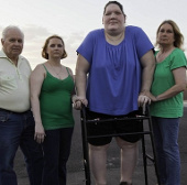 The girl with the syndrome of