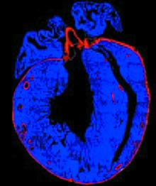 The heart has the ability to heal itself