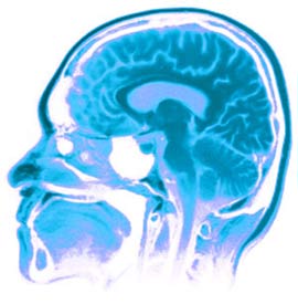 The human brain continues to evolve