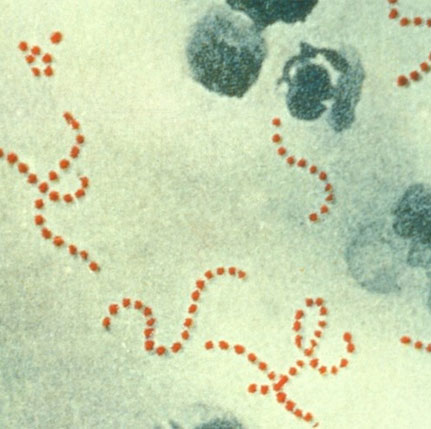 The human parasite-eating monsters