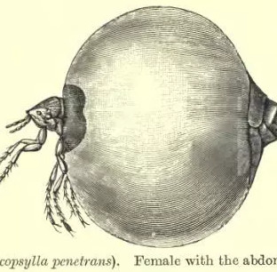 The Jigger - The bug all your life you don't want to encounter