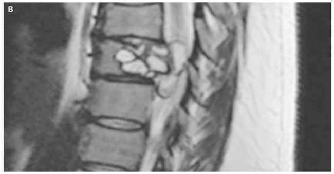 The knee throbbed like an electric shock, the woman accidentally discovered a strange disease