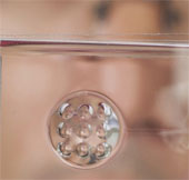 The lens combines the human eye - the insect