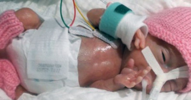 The lightest baby born in the world