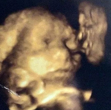 The lost grandfather appeared in the ultrasound image of the great-grandchild