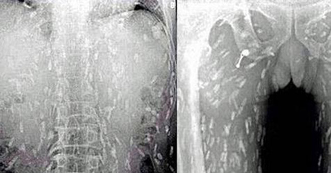 The man eating sashimi felt itchy, taking X-ray images of scary images