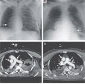 The man has a 'walking' heart in his chest
