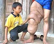 The man has an elephant's leg