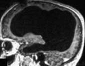 The man shocked with the tiny brain