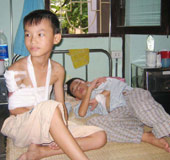 The Ministry of Health provides a way to resolve Delta fibrosis in Ha Tay
