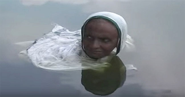 The mysterious disease caused the woman to become a