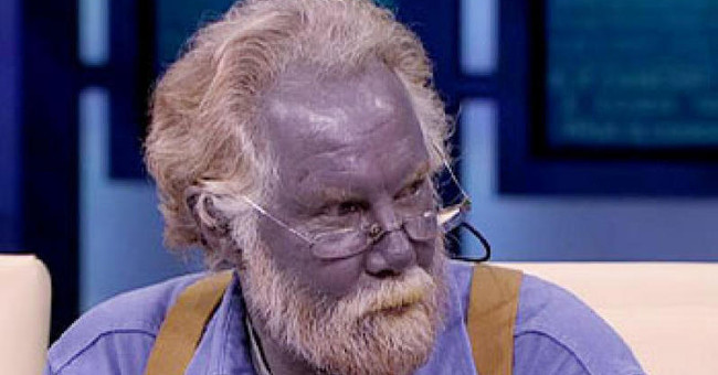 The mystery of blue-skinned people