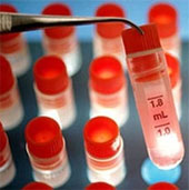 The mystery of immortal human body cells