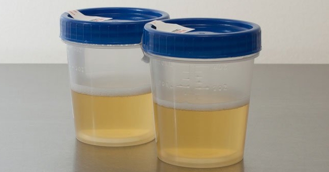 The new invention could turn urine into electricity