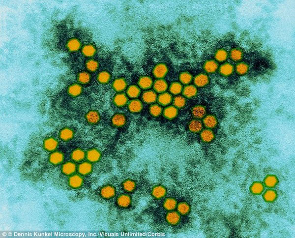 The new virus causes paralysis in children
