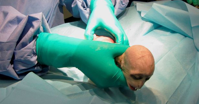 The newborn monkey has the same face as the Dark Lord Voldemort