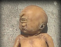 The one-eyed baby was born in India