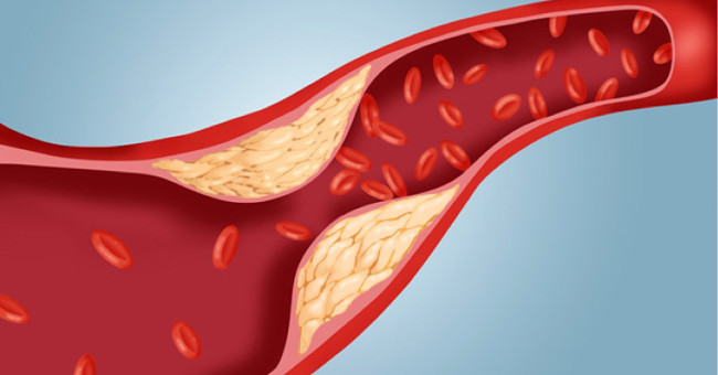 The other side of cholesterol is little known