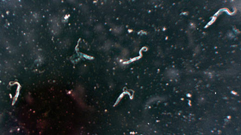 The parasite in the bug bugs sucks blood that has been spread through mice