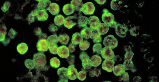 The parasite is in danger of extinction due to climate change