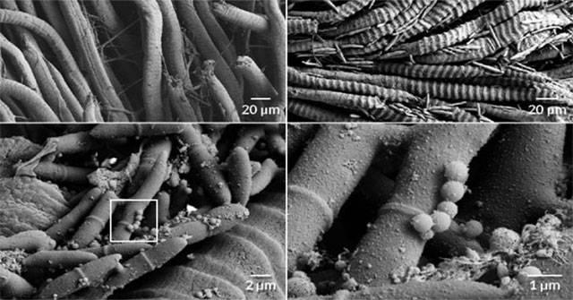 The parasite killer fungus causes the ants to die slowly in pain