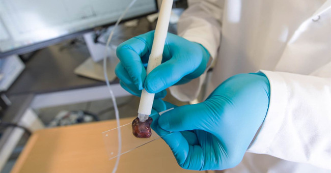 The pen detects cancer for 10 seconds