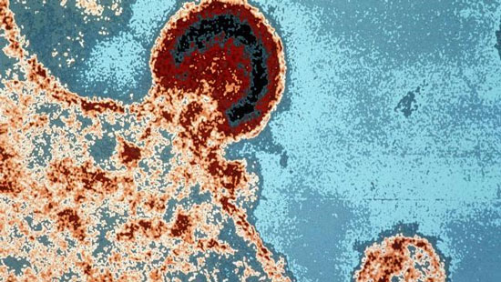 The player decodes the enzyme structure of the AIDS virus