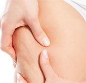 The reason makes the skin rough like orange peel