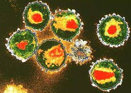 The researchers developed a more sensitive way to find HIV drug resistance