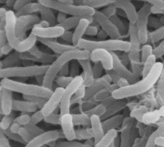 The risk of food poisoning increases because the ocean is warmer