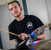 The robotic arm helps the person who loses his hand to play the drums