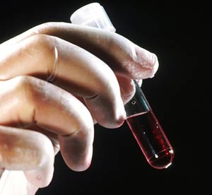 The scary truth about human drug testing