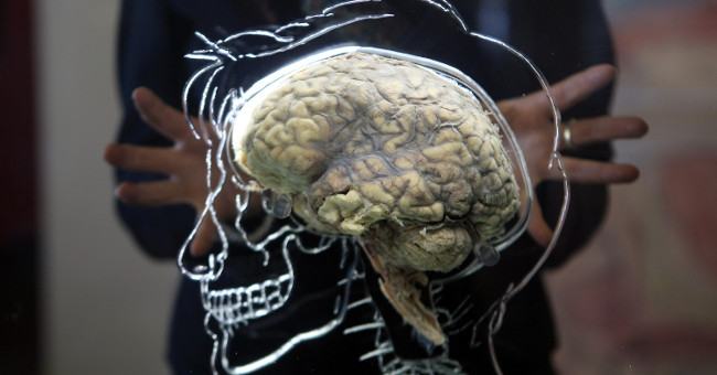 The scientist claims to help the brain dead again