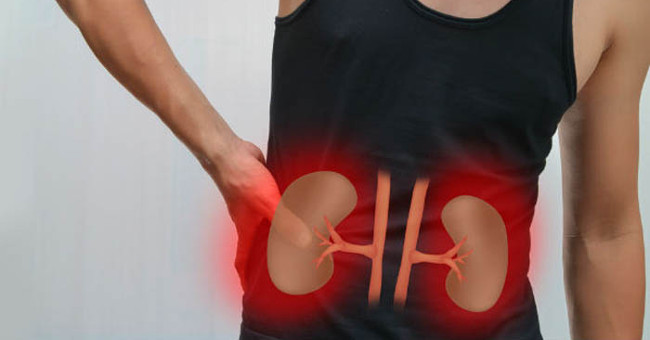 The secret to kidney stones doesn't need surgery