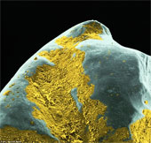 The shape of bacteria attaches to human teeth