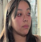 The sick girl cries out ... blood
