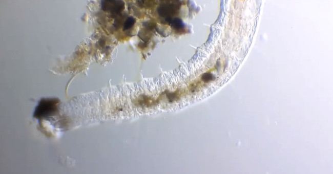 The sight of worms eating algae magnifies 250 times