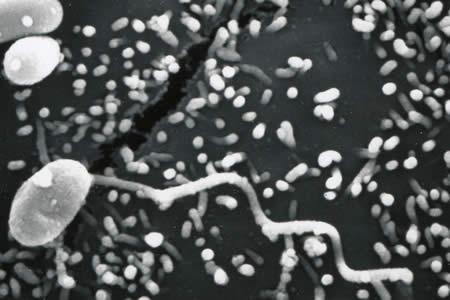 The small fungus reproduces sexually when it infects the host