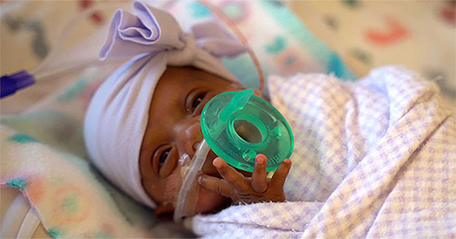 The smallest baby in the world miraculously survives even though it is about the size of an ... apple