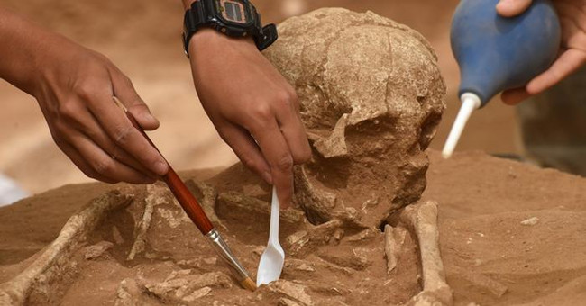 The surgery for piercing the skull was 3,000 years ago