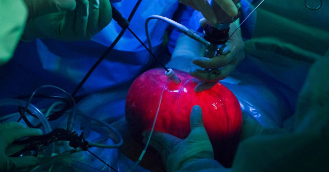The surgery is bizarre: Remove the uterus from the mother, inflate it for surgery for the fetus