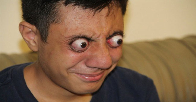 The teenager has the ability to take a protruding eyeball without any harm