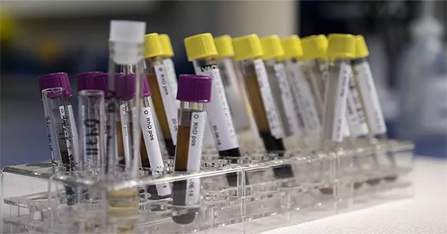 The test identifies all the bacteria that enter the body