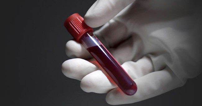 The things doctors won't reveal in your blood test